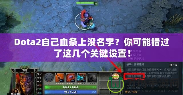 Dota2自己血條上沒名字？你可能錯過了這幾個關(guān)鍵設(shè)置！